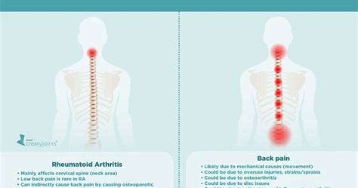 Does Ra Affect the Spine?