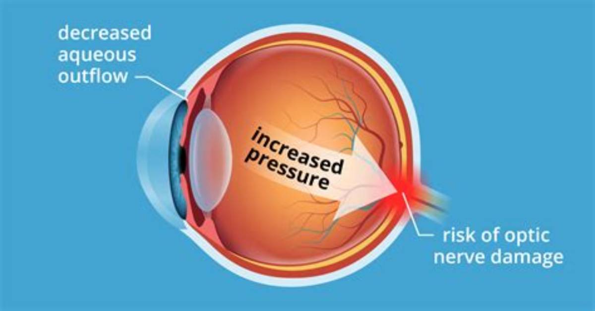 Does Reading Increase Eye Pressure?