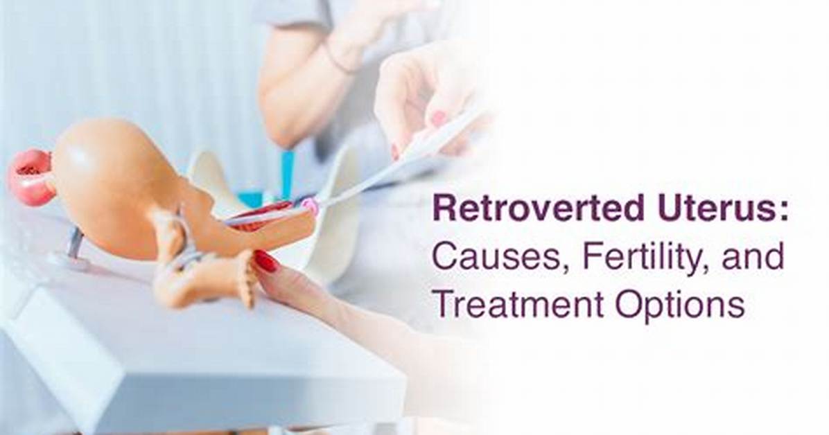 Does Retroverted Uterus Cause Constipation?