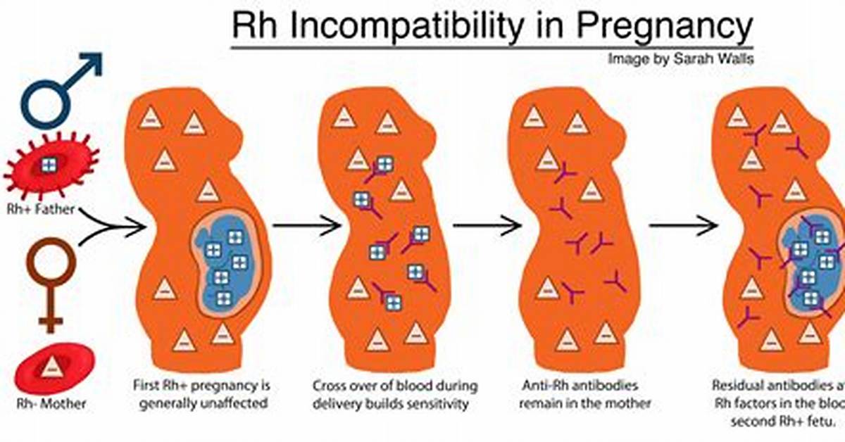 Does Rh Incompatibility Affect First Pregnancy?