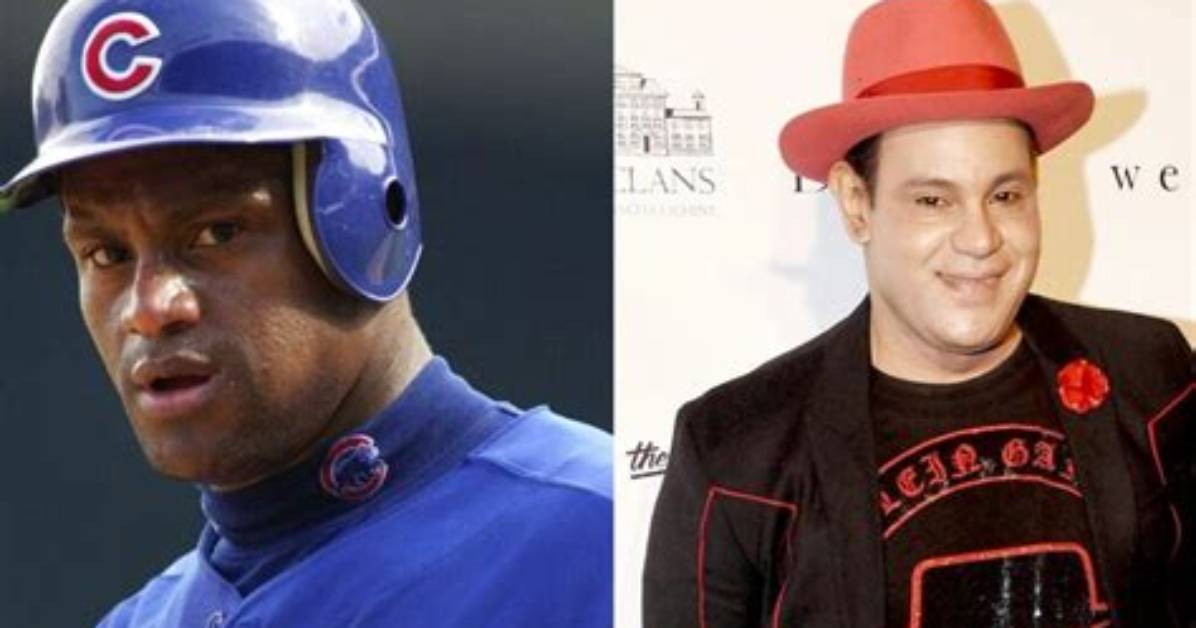 Does Sammy Sosa Have Vitiligo?
