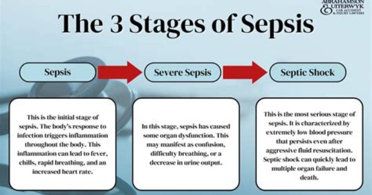 Does Sepsis Make You Itchy?