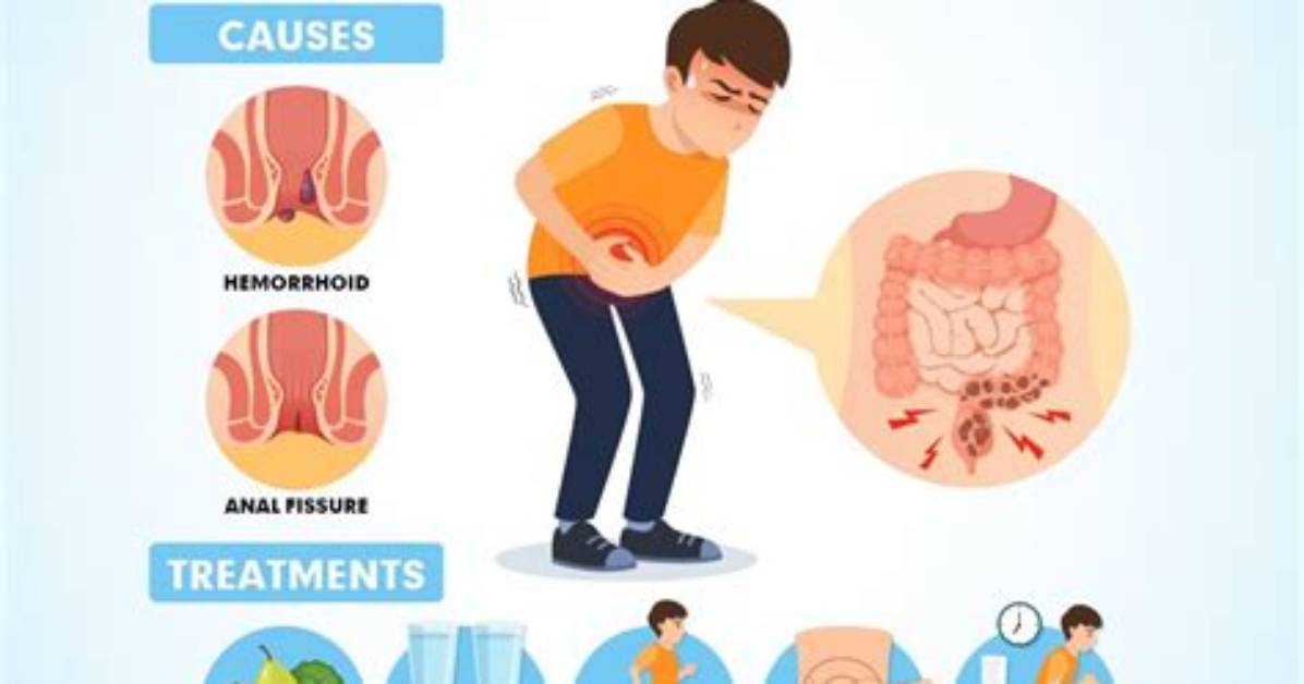 Does Simethicone Cause Constipation