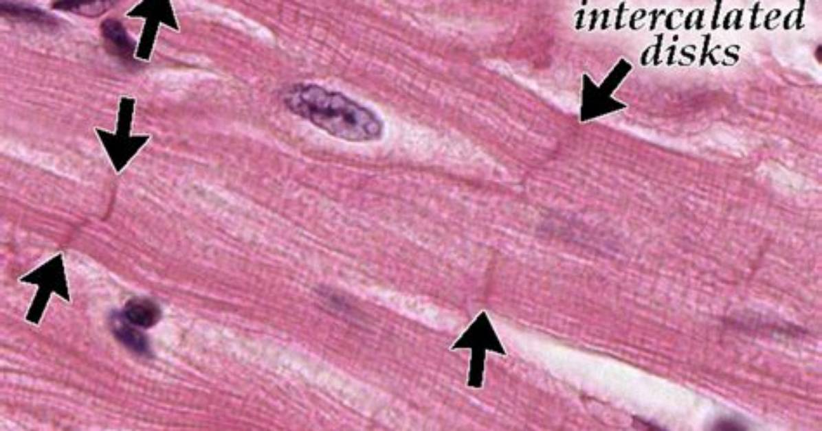 Does Smooth Muscle Have Intercalated Discs?