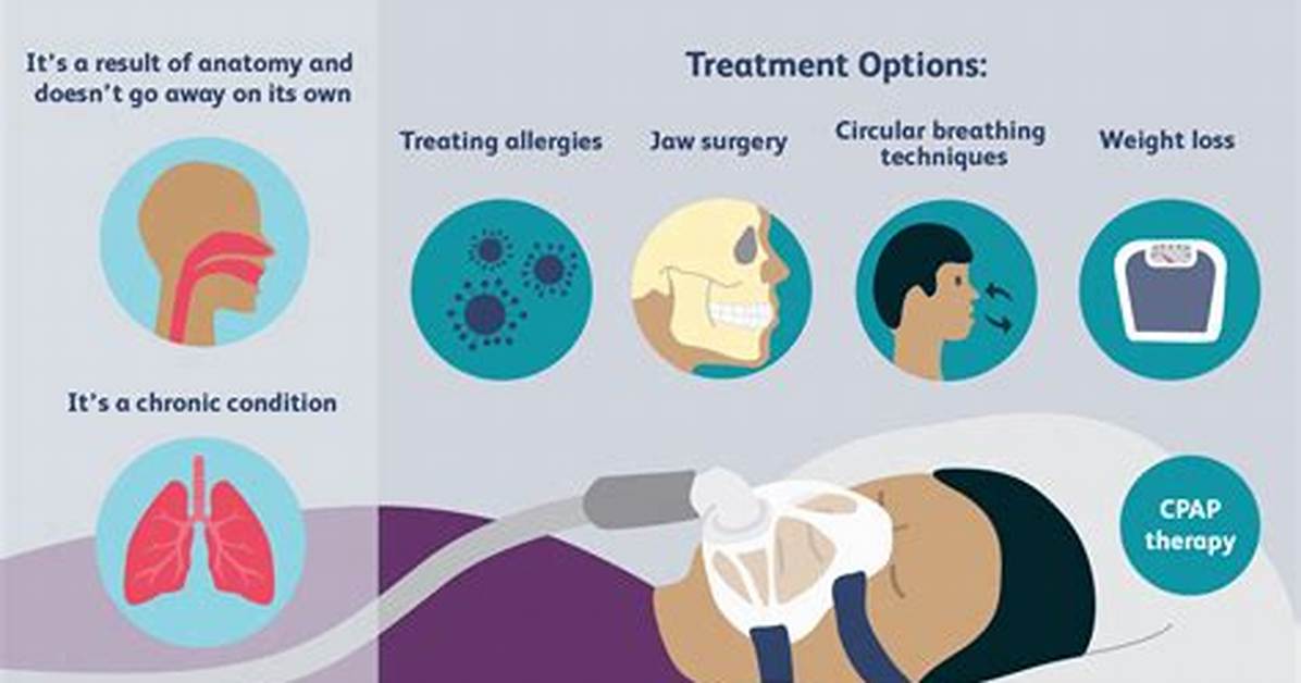Does Somnifix Help Sleep Apnea?