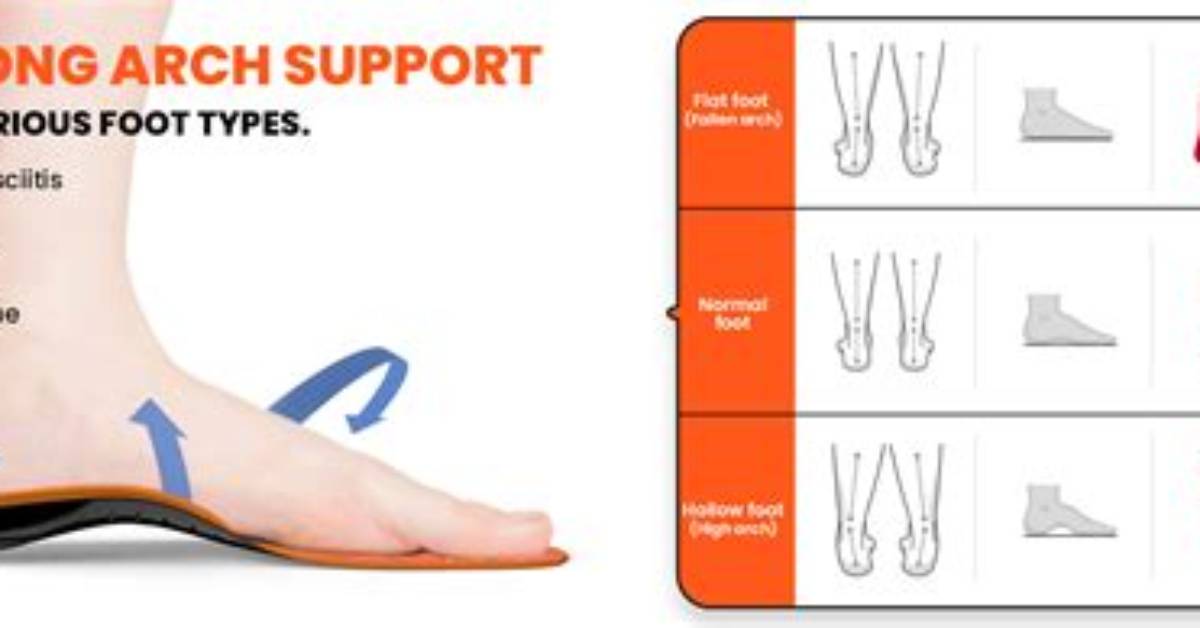 Does Sorel Arch Support