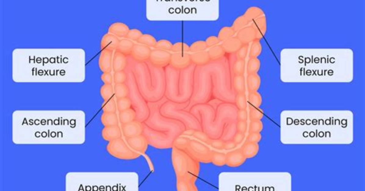 Does Splenic Flexure Go Away?