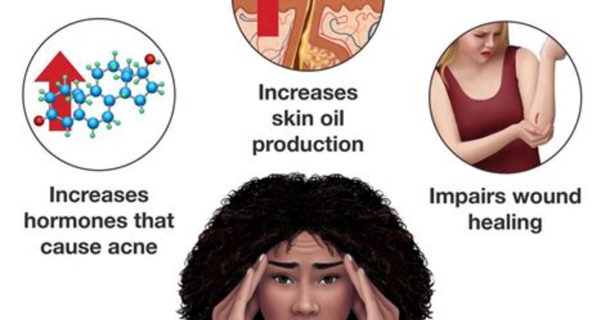 Does Staying up Late Cause Pimples?