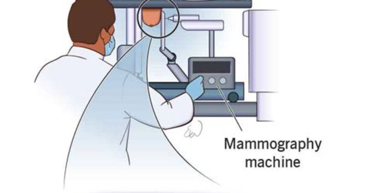 Does Stereotactic Biopsy Hurt?