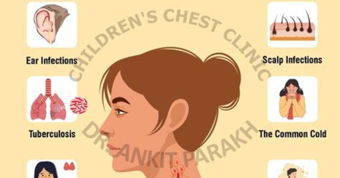 Does Stiff Neck Cause Swollen Lymph Nodes?