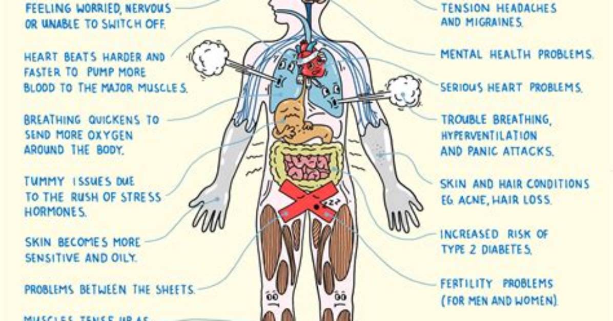 Does Stress Cause Anxiety?