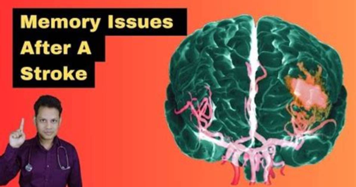 Does Stroke Cause Memory Loss?