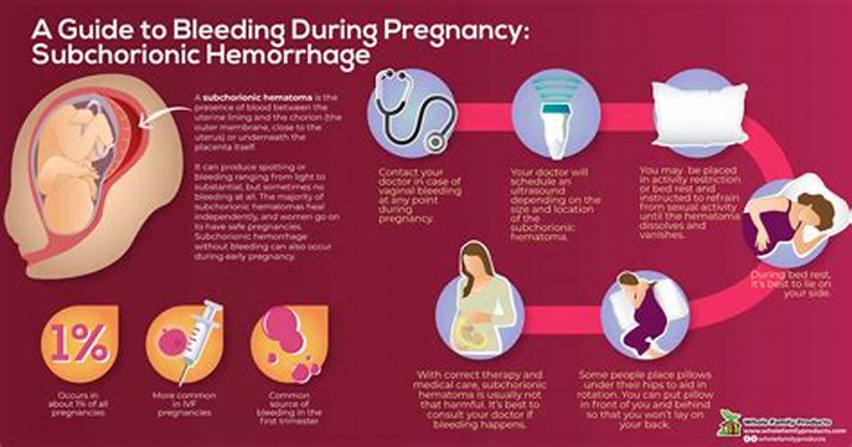 Does Subchorionic Hemorrhage Affect Baby?