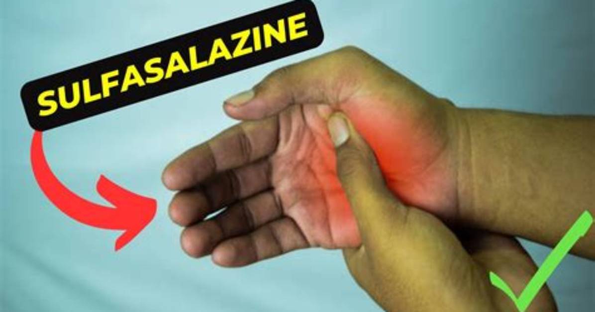 Does Sulfasalazine Cause a Rash?