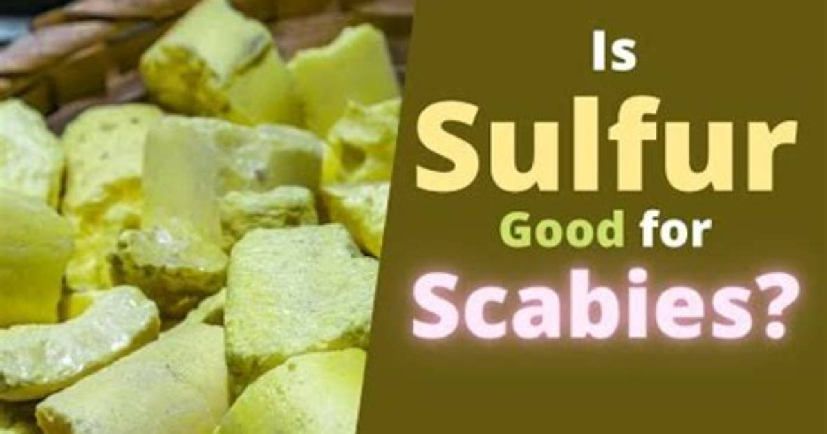 Does Sulphur Kill Scabies?