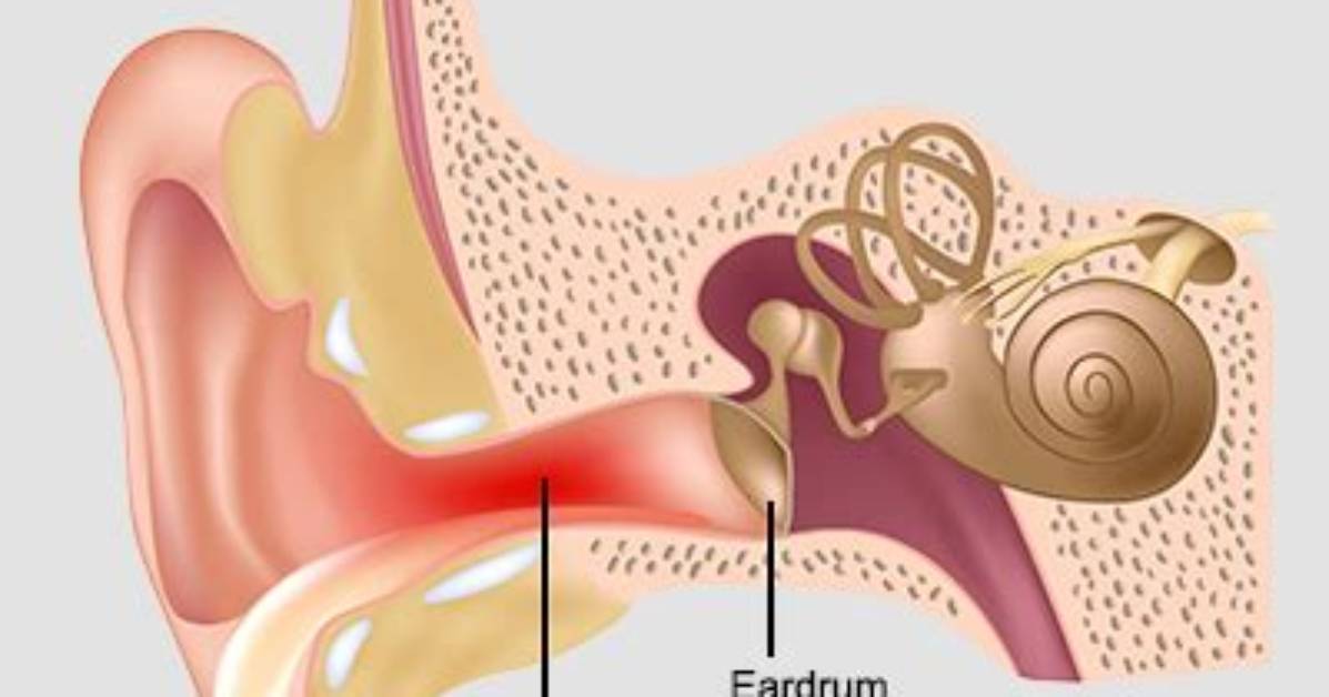 Does Swimmer's Ear Itch?