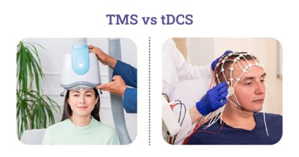 Does Tdcs Work for Depression?