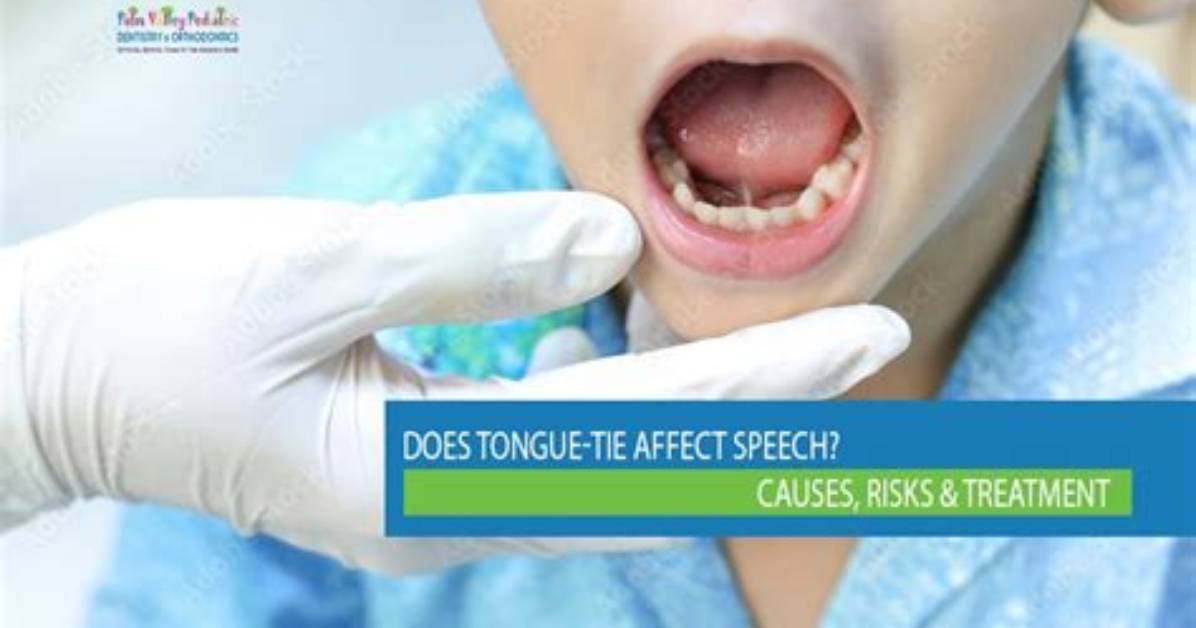 Does Teeth Affect Speech?