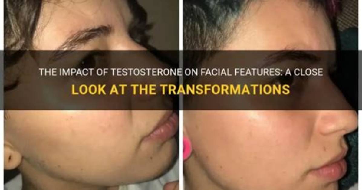 Does Testosterone Affect Face?