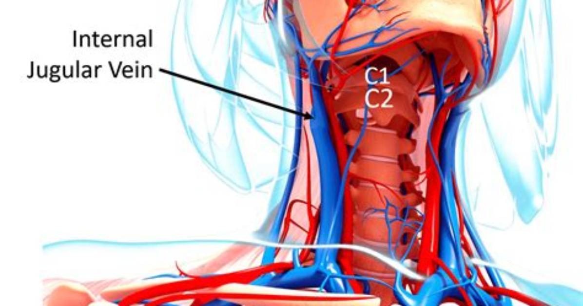 Does the Jugular Vein Have a Pulse?