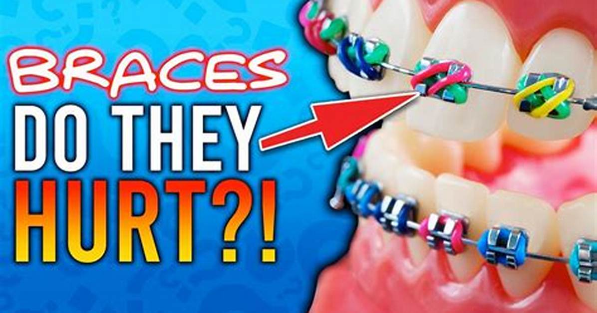 Does the Mold for Braces Hurt?