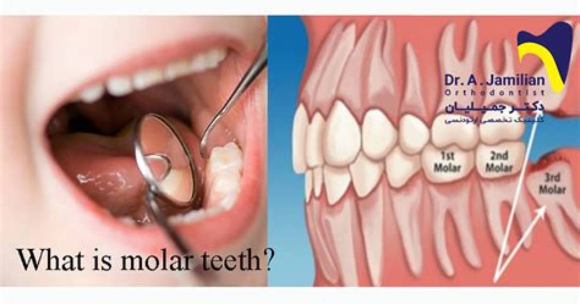 Does the Second Molar Fall out?