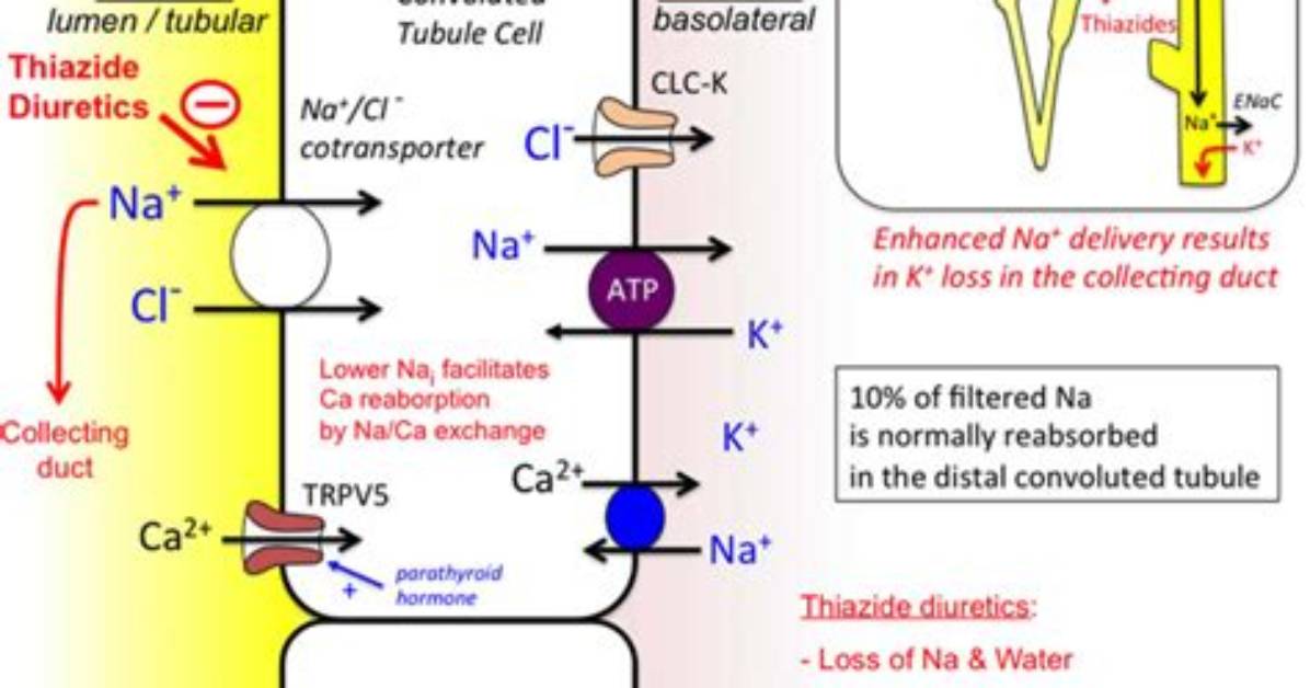 Does Thiazide Diuretics Cause Diabetes?