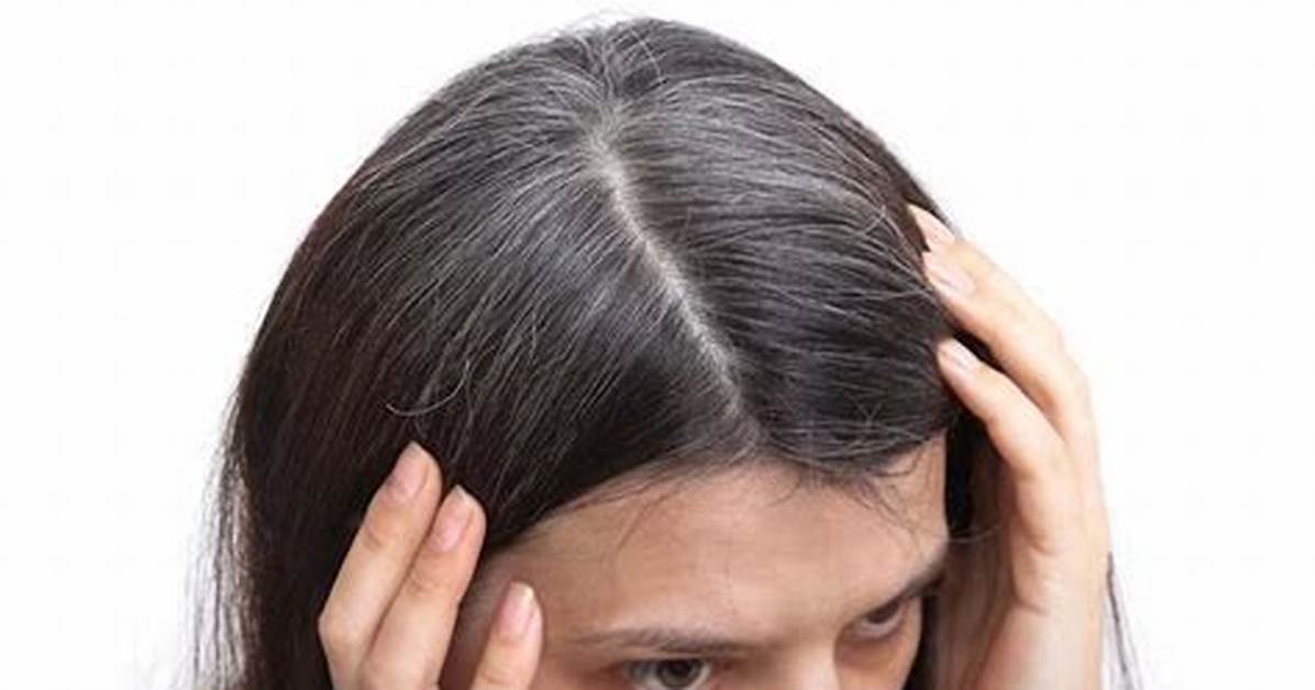 Does Thyroid Cause Grey Hair?