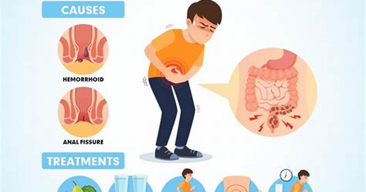 Does Thyroxine Cause Constipation?