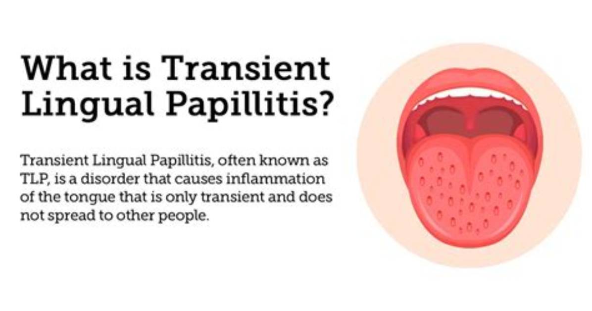 Does Transient Lingual Papillitis Go Away?