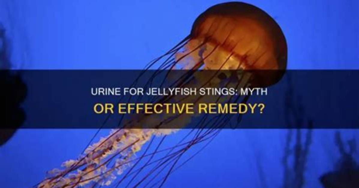 Does Urine Help Jellyfish Stings?
