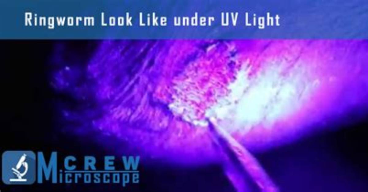 Does Uv Light Kill Ringworm Spores