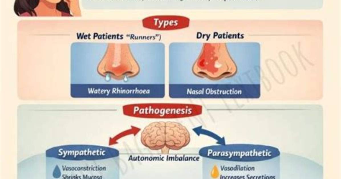 Does Vasomotor Rhinitis Cause Headaches?