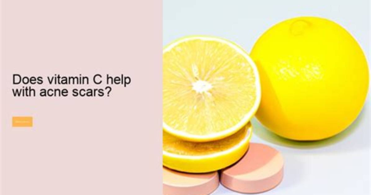 Does Vitamin C Help with Acne Scars?