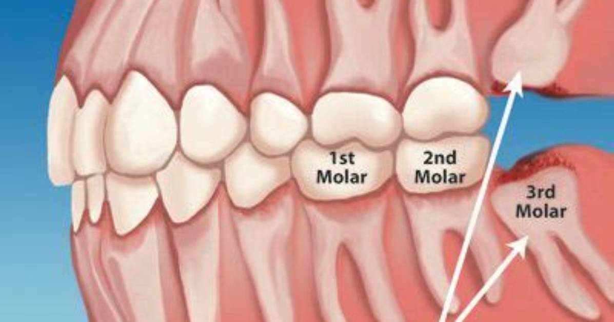 Does Your Molars Grow Back?