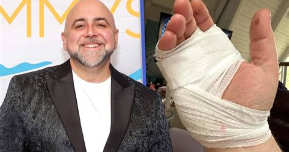 Duff Goldman Suffers Hand Injury After Car Accident
