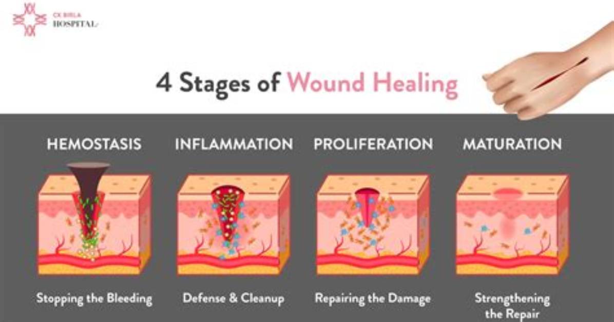 During the Normal Wound Healing Process?