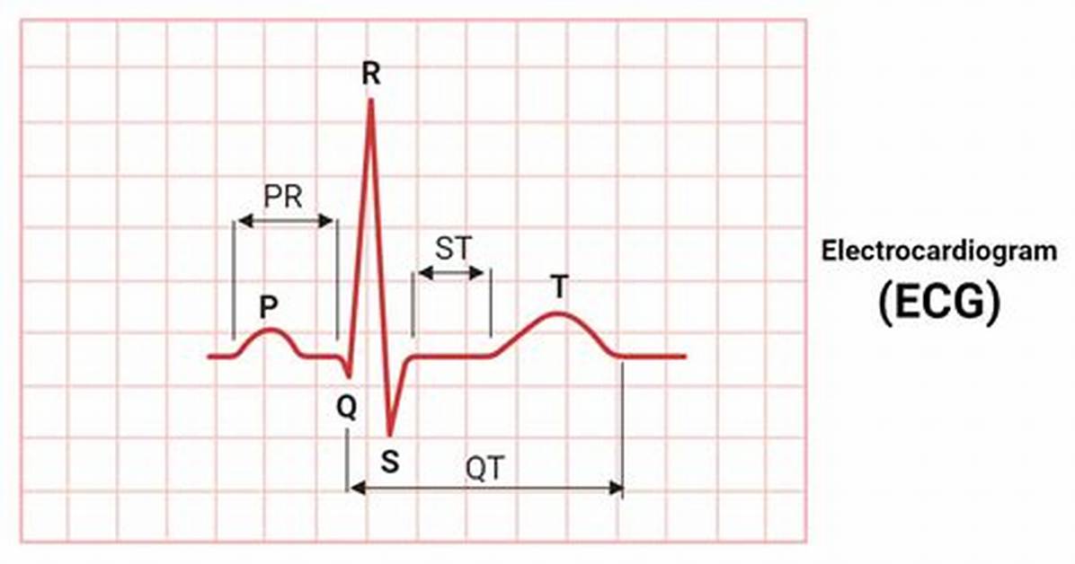 Ecg - Electrocardiogram Quiz
