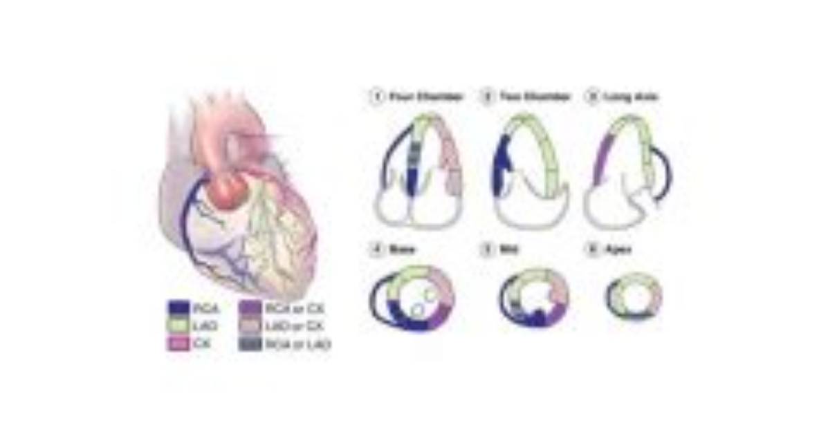Echocardiography Lv Wall Segment Id Quiz