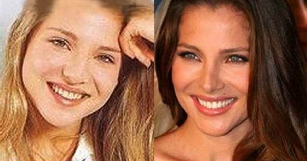 Elsa Pataky Nose Job Plastic Surgery Before and After