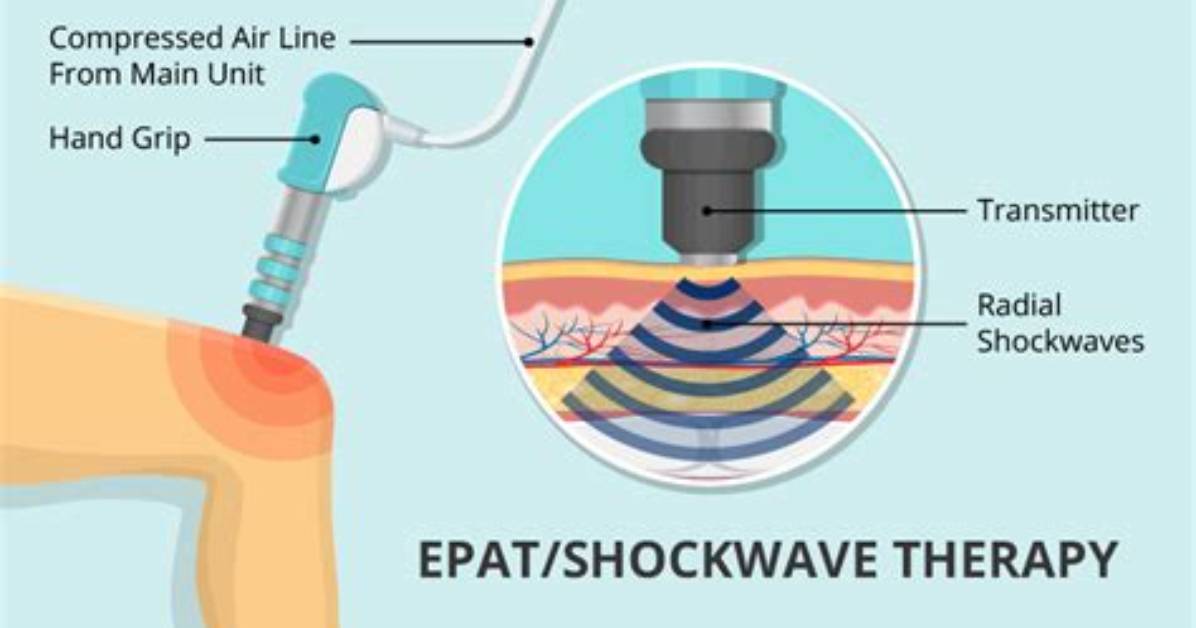 Epat® Therapy