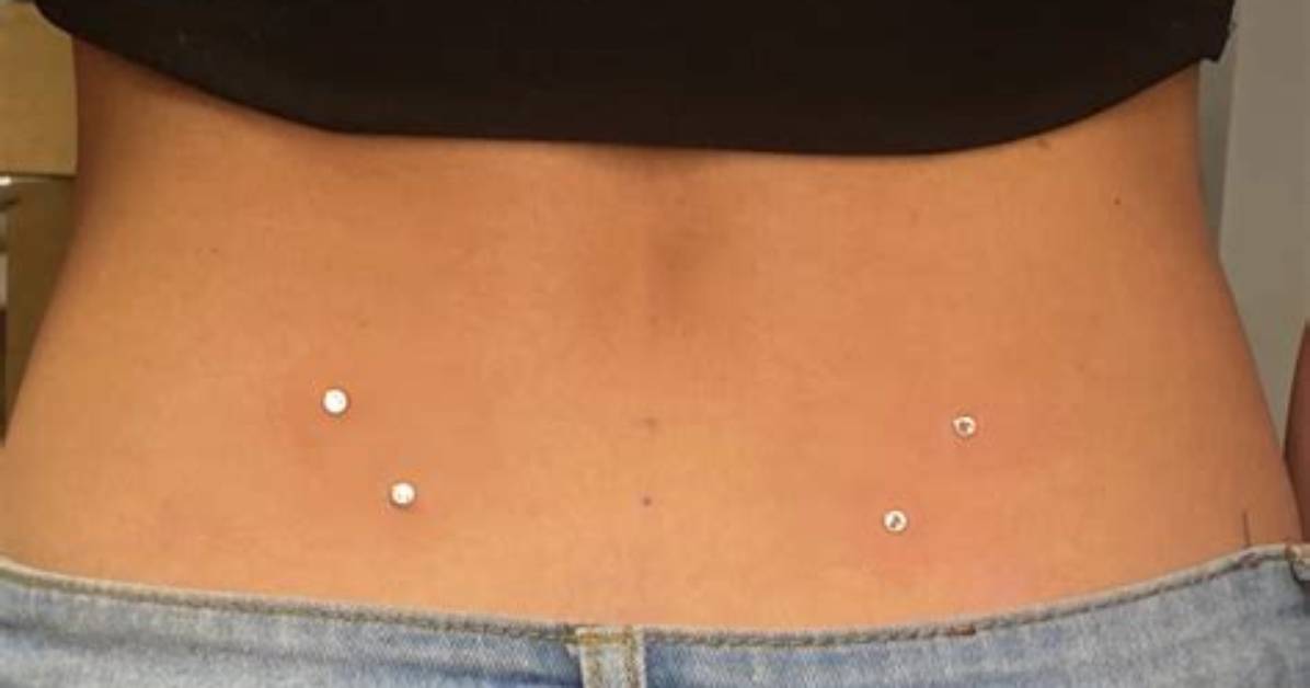 Everything About Back Dermal Piercing