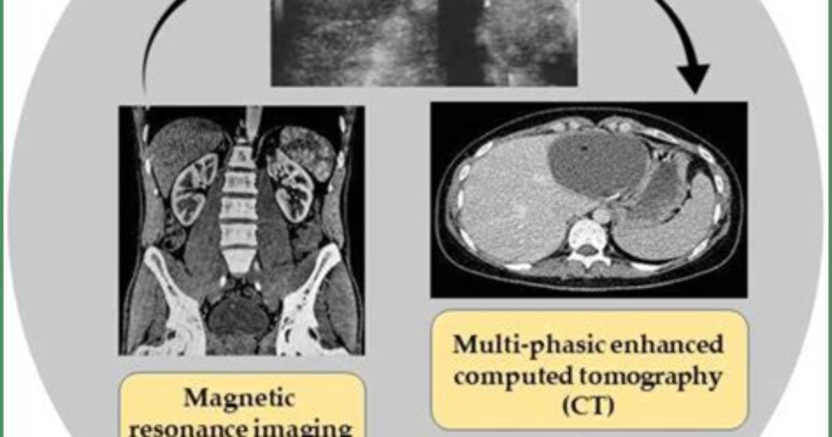 Exploring Camilla's Condition: a Comprehensive Overview
