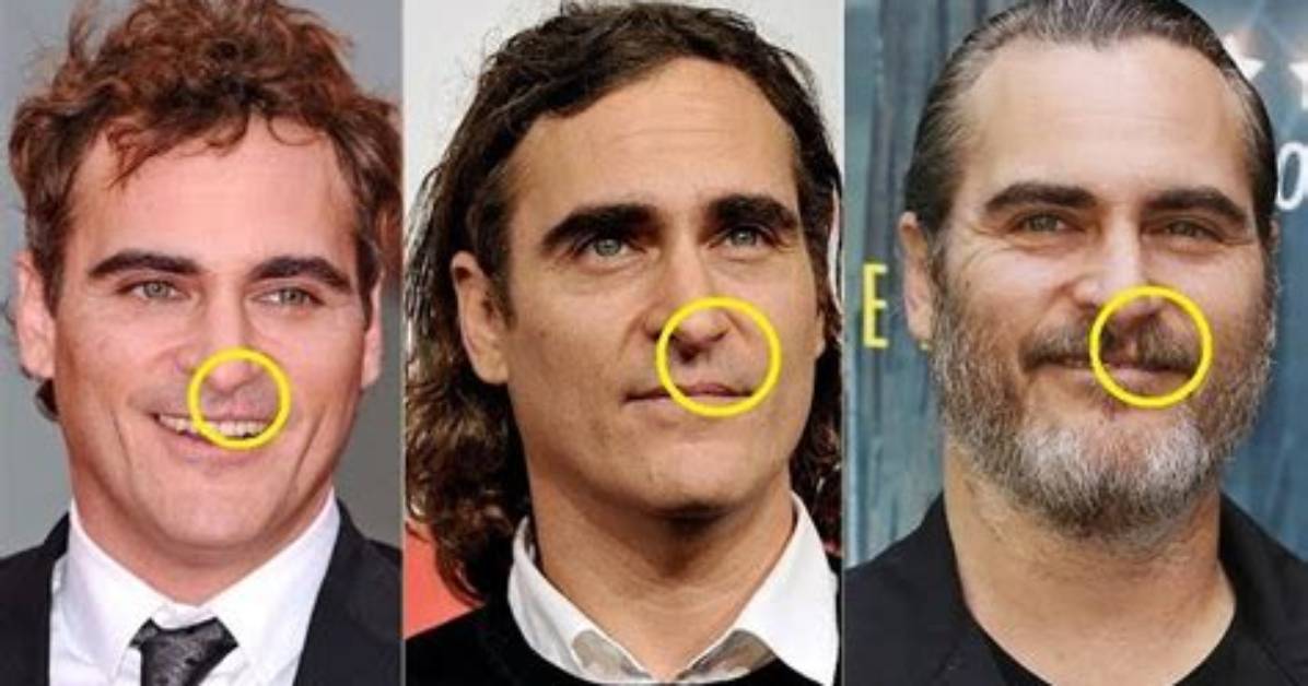 Exploring Joaquin Phoenix's Scar: a Journey Through His Life and Career
