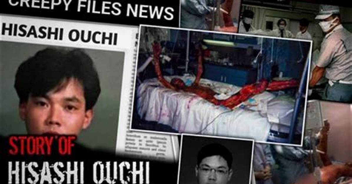 Exploring the Life and Legacy of Hisashi Ouchi: a Tragic Case of Radiation Exposure