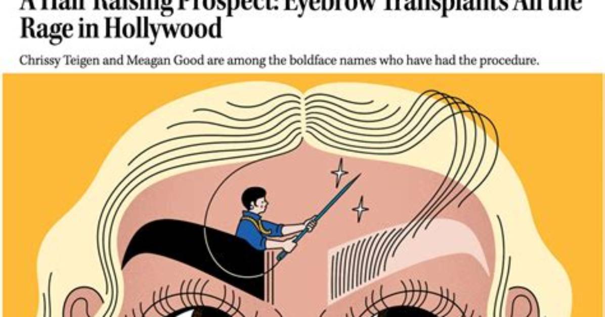 Eyebrow Transplants All the Rage in Hollywood