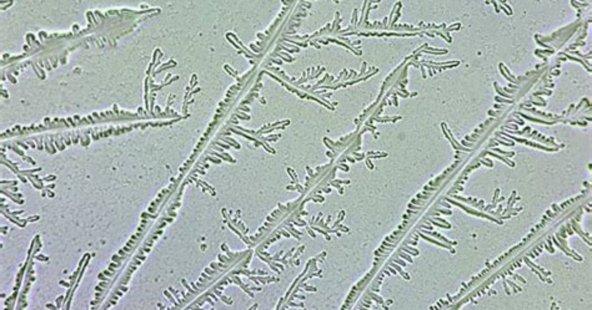 Fern Test Pregnancy