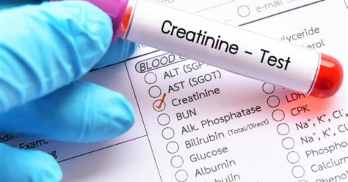 For Creatinine Blood Test?