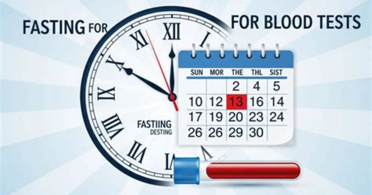 For Kft Is Fasting Required?