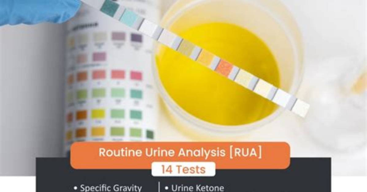 For Routine Urine Test?